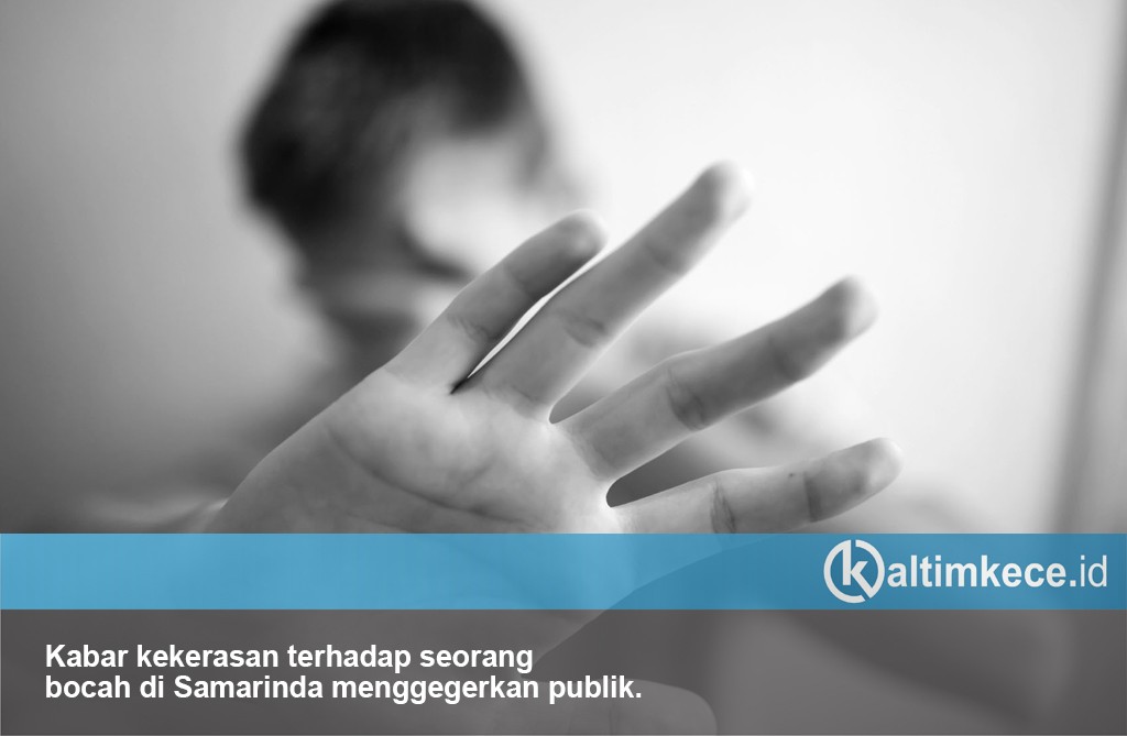 Teka-Teki Bocah yang Viral karena Diduga Disiksa Ayah Tiri