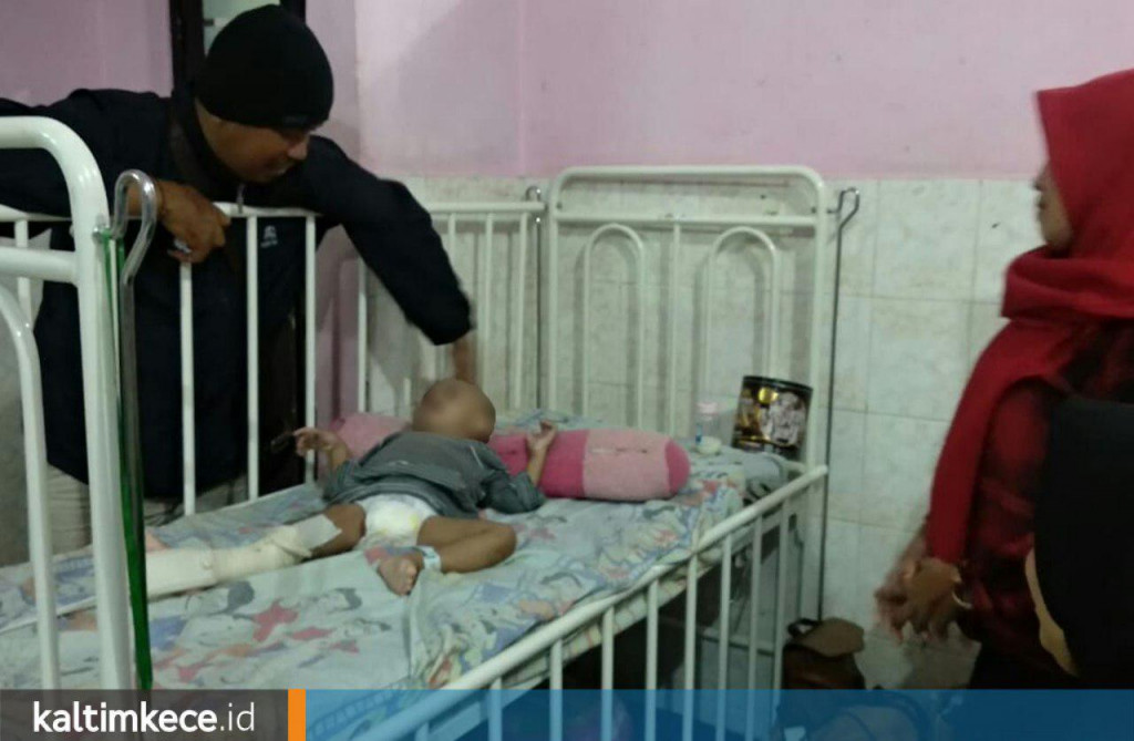 Ibu yang Patahkan Kaki Anak Kandung Dipastikan Depresi karena Cerai dan Korban KDRT