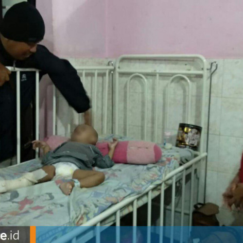 Ibu yang Patahkan Kaki Anak Kandung Dipastikan Depresi karena Cerai dan Korban KDRT